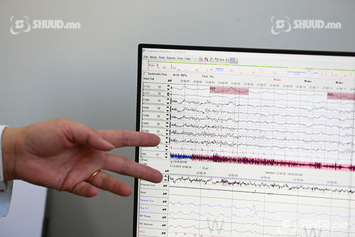 Фото: Нойрны эмгэгийг оношилж, эмчлэх төвтэй болов
